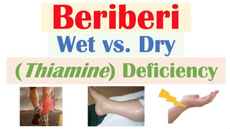 is dry beriberi dangerous.